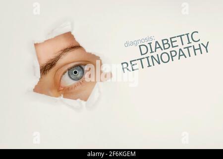 Woman`s eye looking trough teared hole in paper, eye test with words Diabetic Retinopathy on right. Eye disease concept template. Grey background. Stock Photo